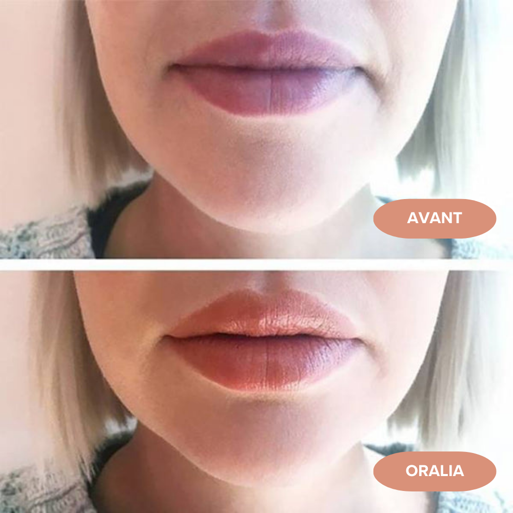 Lip plumper Oralia